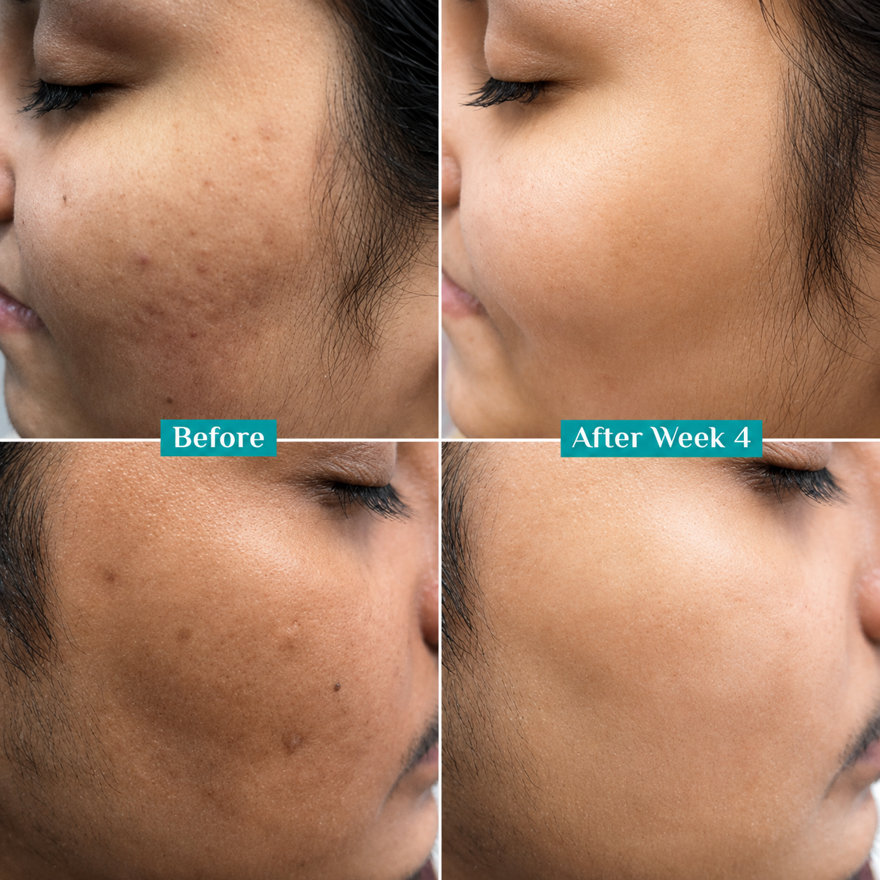 Tea Shell Serum