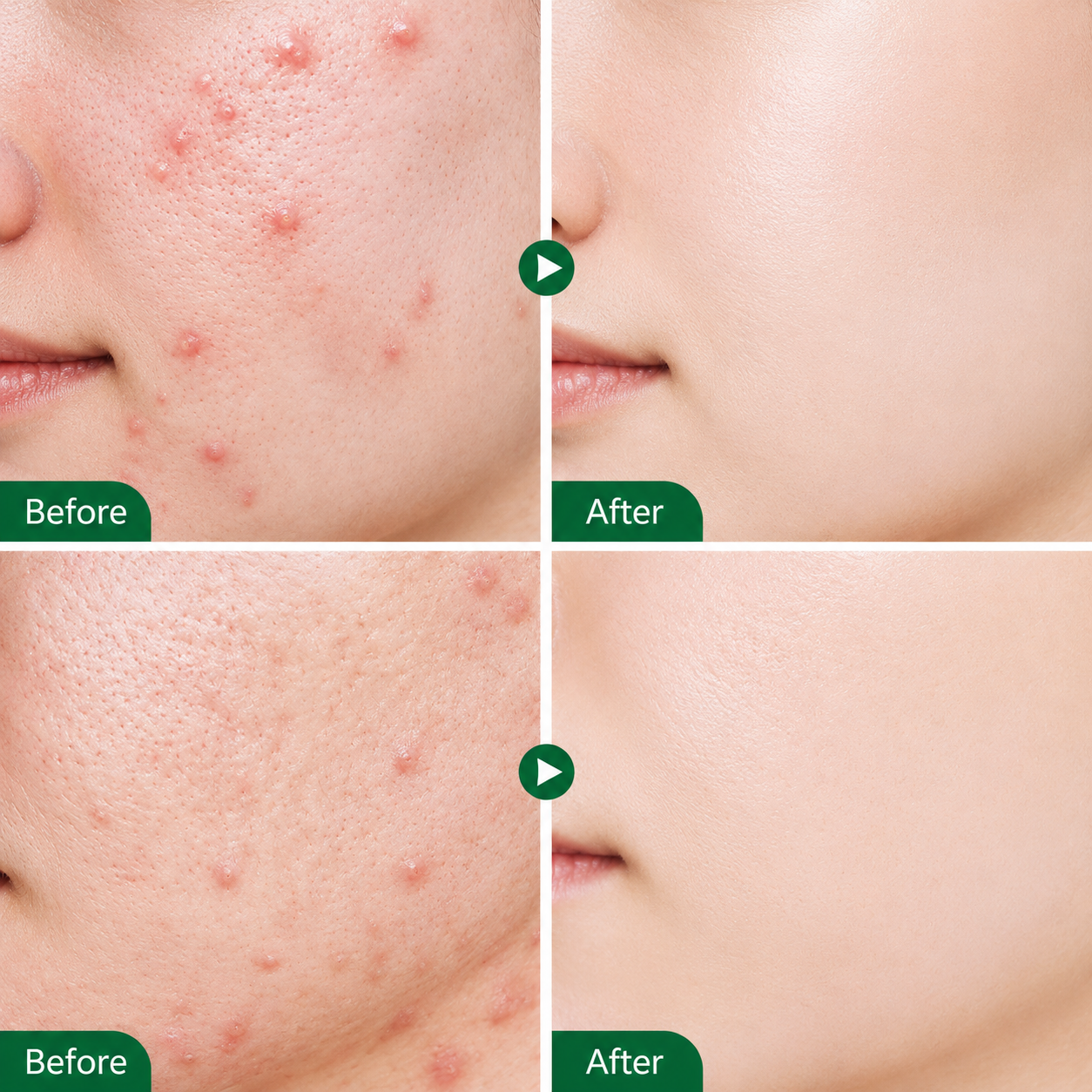 Tea Shell Serum