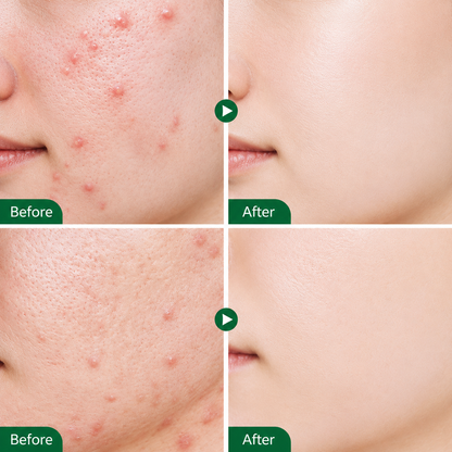 Tea Shell Serum