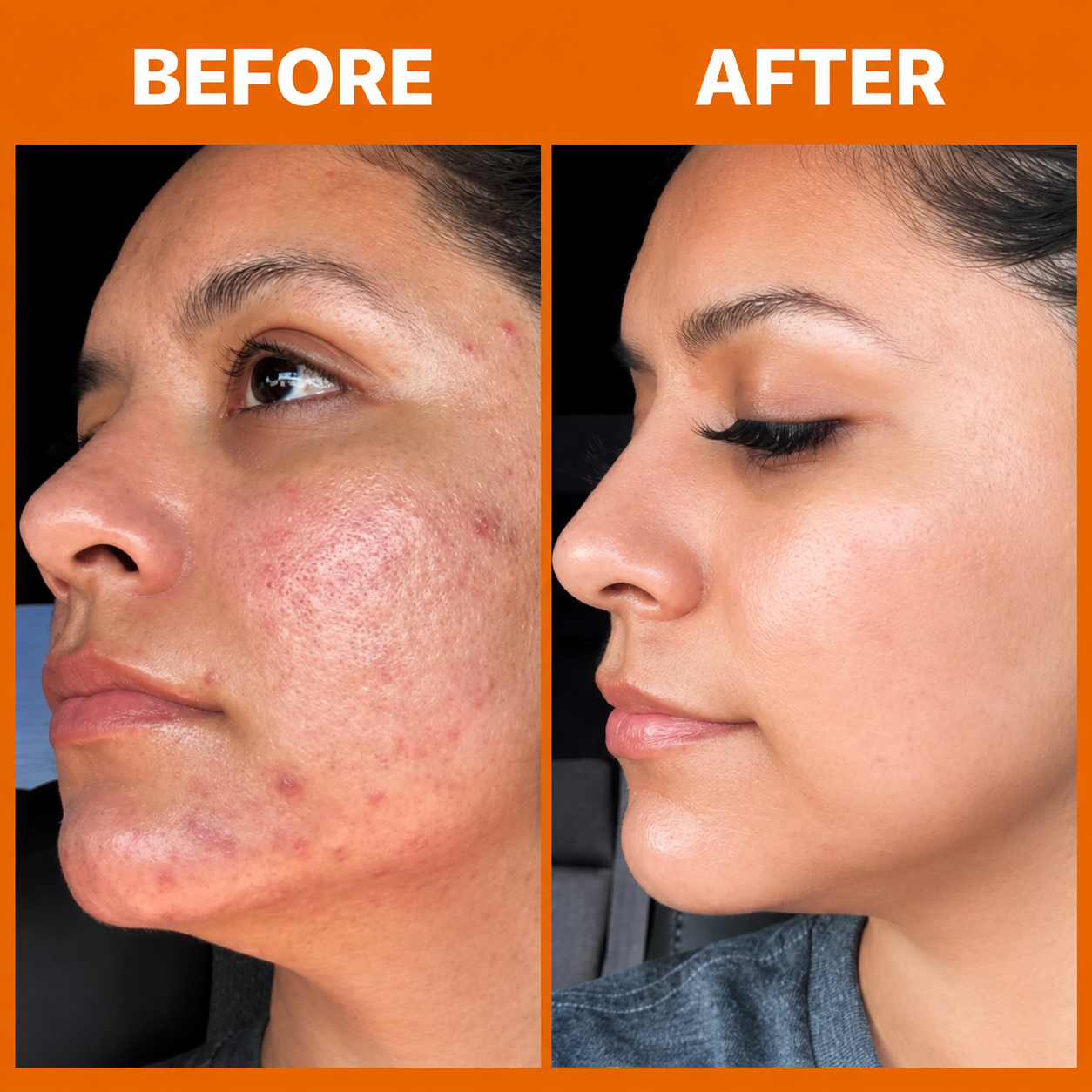 Tea Shell Serum
